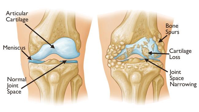 knee pain specialist in Odisha