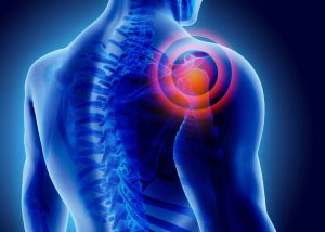 shoulder pain treatment