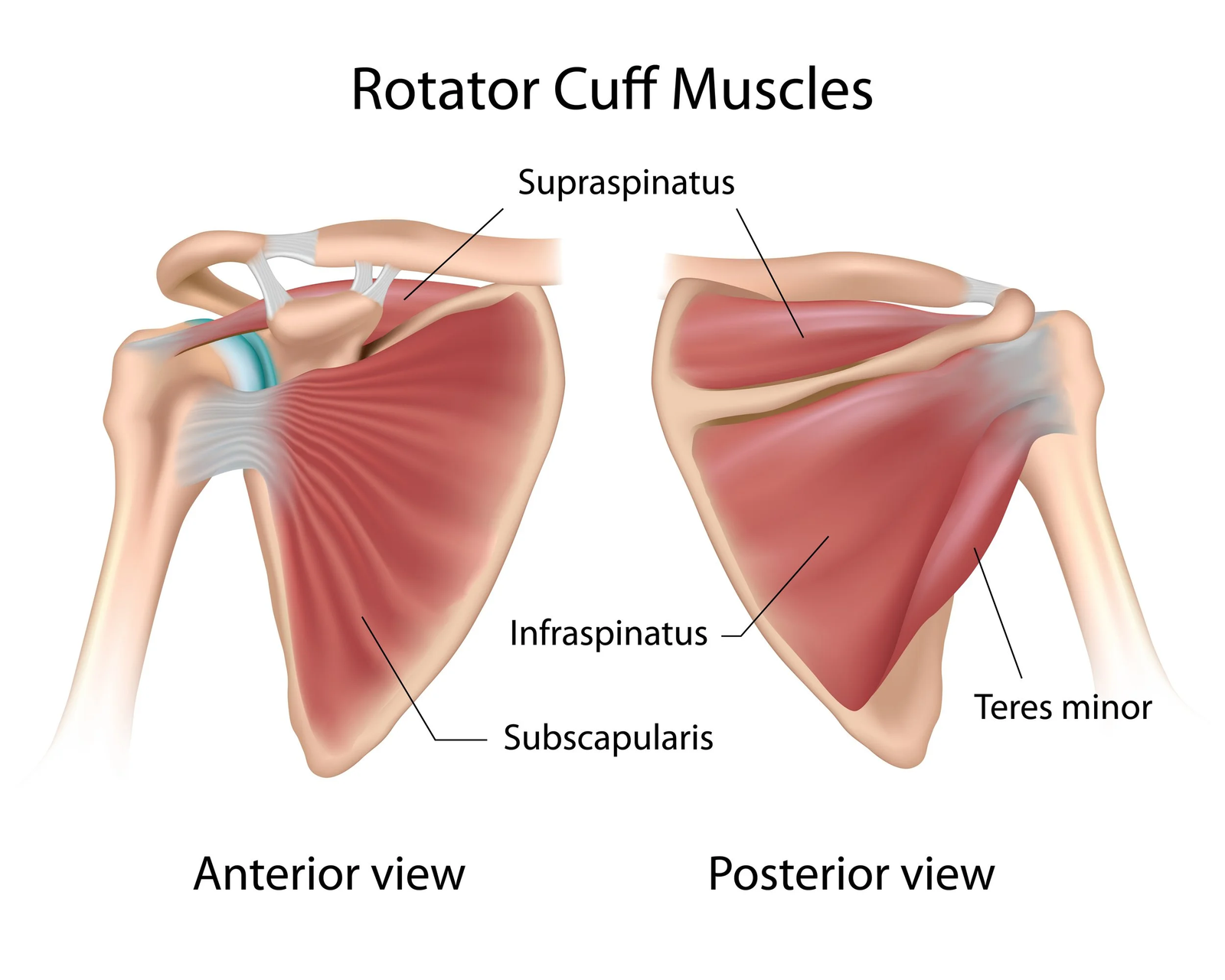 Shoulder Pain and problem with movement: Is It a Rotator Cuff issue or Frozen Shoulder?